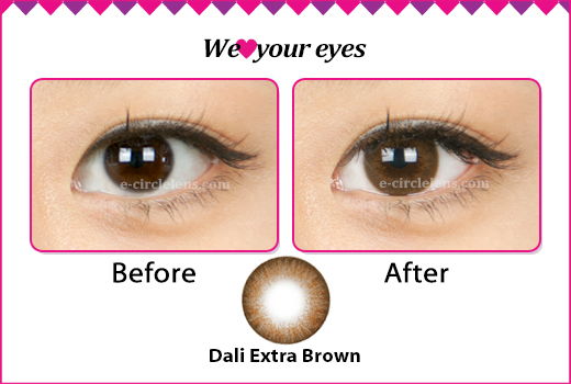 dark brown circle lenses before and after